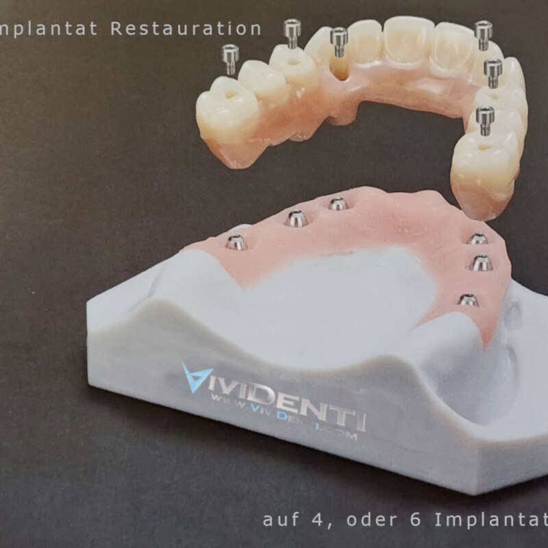 4_6 Implantate hoch