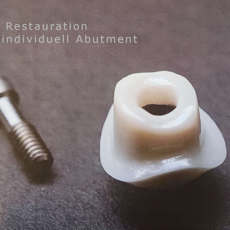 individuell abutment